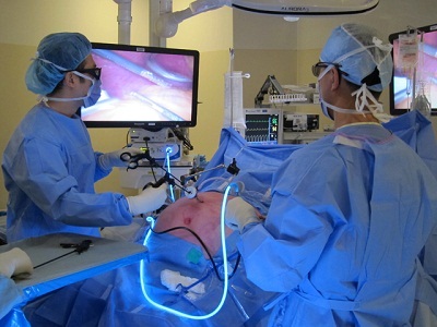 Doctors doing laparoscopic surgery